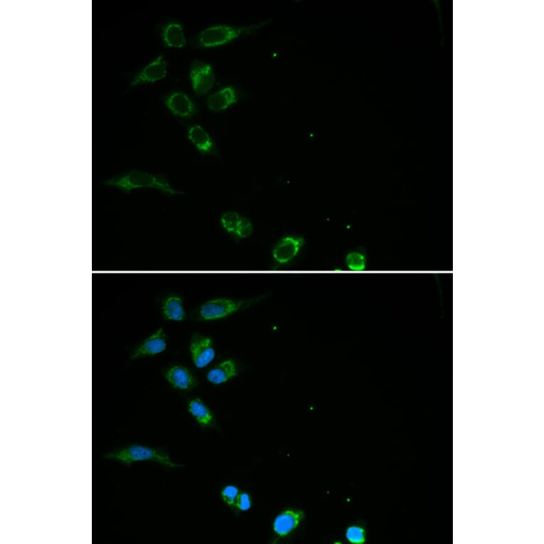 Immunofluorescence - HFE Antibody from Signalway Antibody (32264) - Antibodies.com