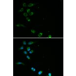 Immunofluorescence - HFE Antibody from Signalway Antibody (32264) - Antibodies.com