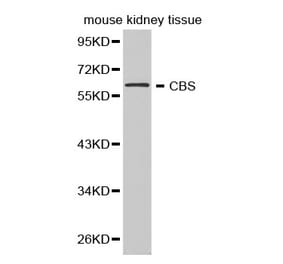 Western blot - CBS Antibody from Signalway Antibody (32276) - Antibodies.com