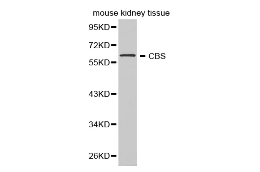 Western blot - CBS Antibody from Signalway Antibody (32276) - Antibodies.com