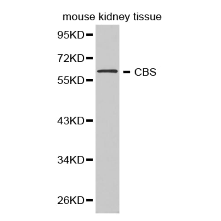 Western blot - CBS Antibody from Signalway Antibody (32276) - Antibodies.com