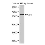 Western blot - CBS Antibody from Signalway Antibody (32276) - Antibodies.com