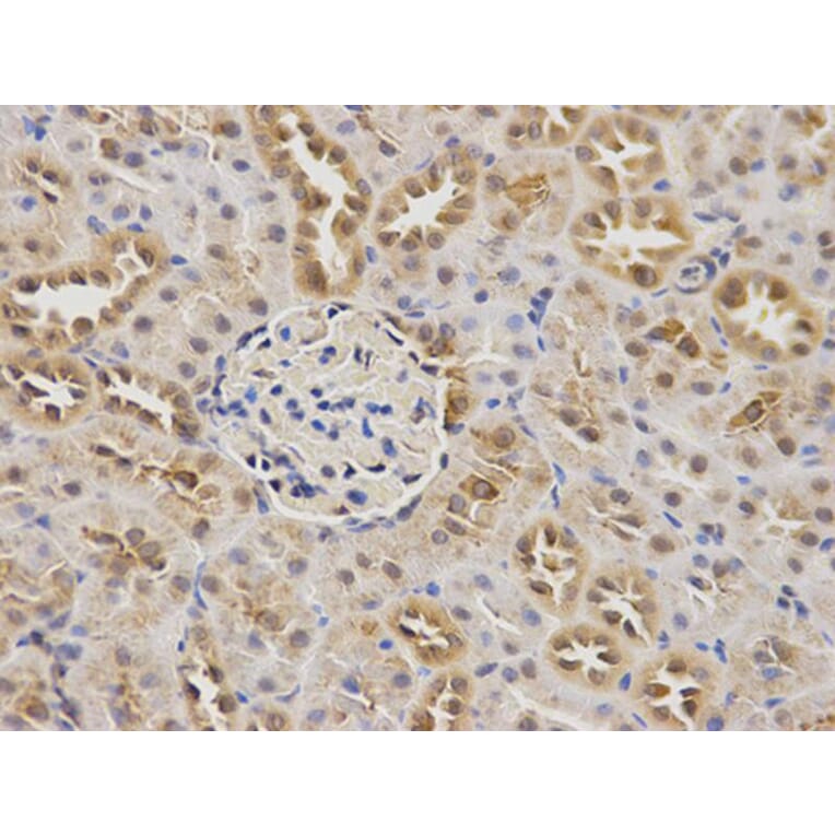 Immunohistochemistry - CBS Antibody from Signalway Antibody (32276) - Antibodies.com