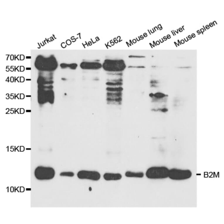 Western blot - B2M Antibody from Signalway Antibody (32309) - Antibodies.com