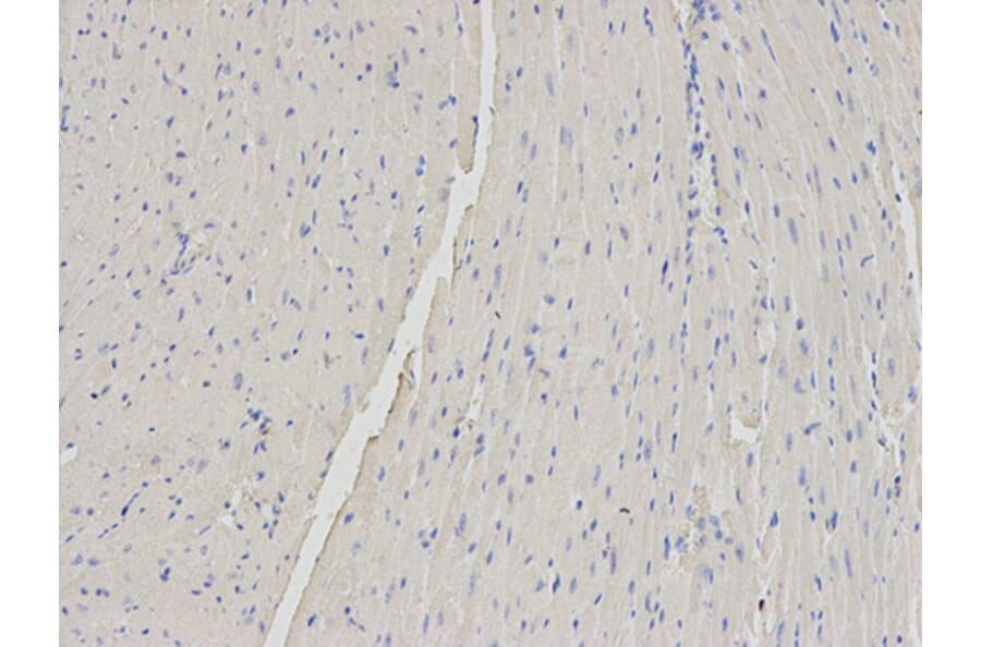 Immunohistochemistry - B2M Antibody from Signalway Antibody (32309) - Antibodies.com