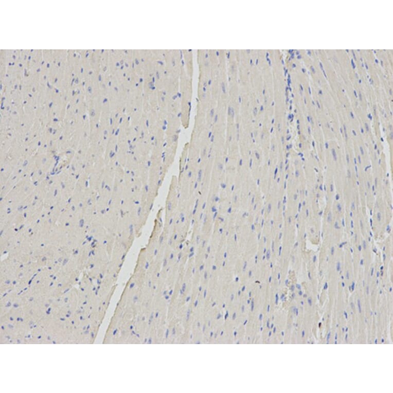 Immunohistochemistry - B2M Antibody from Signalway Antibody (32309) - Antibodies.com