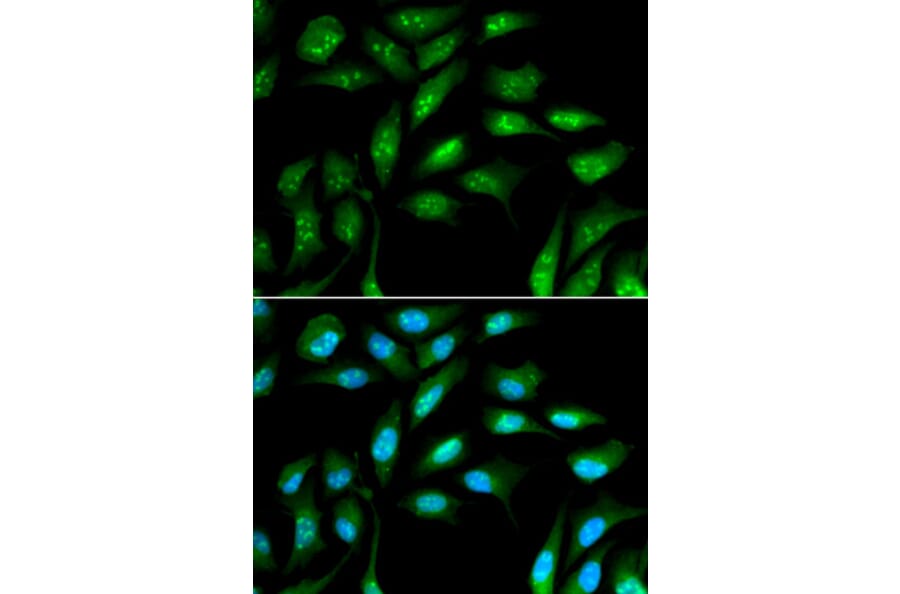Immunofluorescence - B2M Antibody from Signalway Antibody (32309) - Antibodies.com