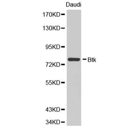 Western blot - BTK Antibody from Signalway Antibody (32321) - Antibodies.com