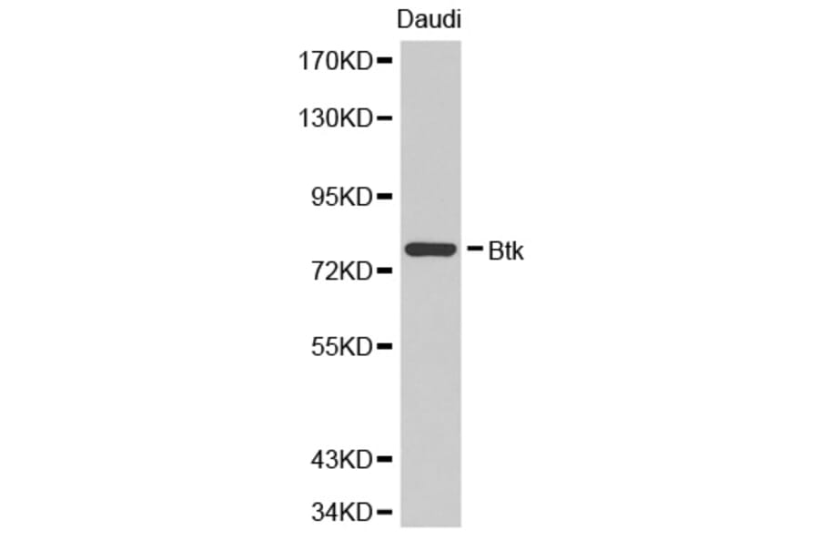 Western blot - BTK Antibody from Signalway Antibody (32321) - Antibodies.com