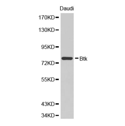 Western blot - BTK Antibody from Signalway Antibody (32321) - Antibodies.com