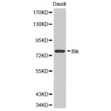 Western blot - BTK Antibody from Signalway Antibody (32321) - Antibodies.com