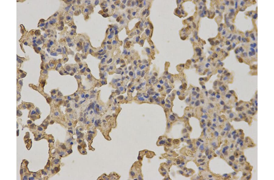 Immunohistochemistry - BTK Antibody from Signalway Antibody (32321) - Antibodies.com