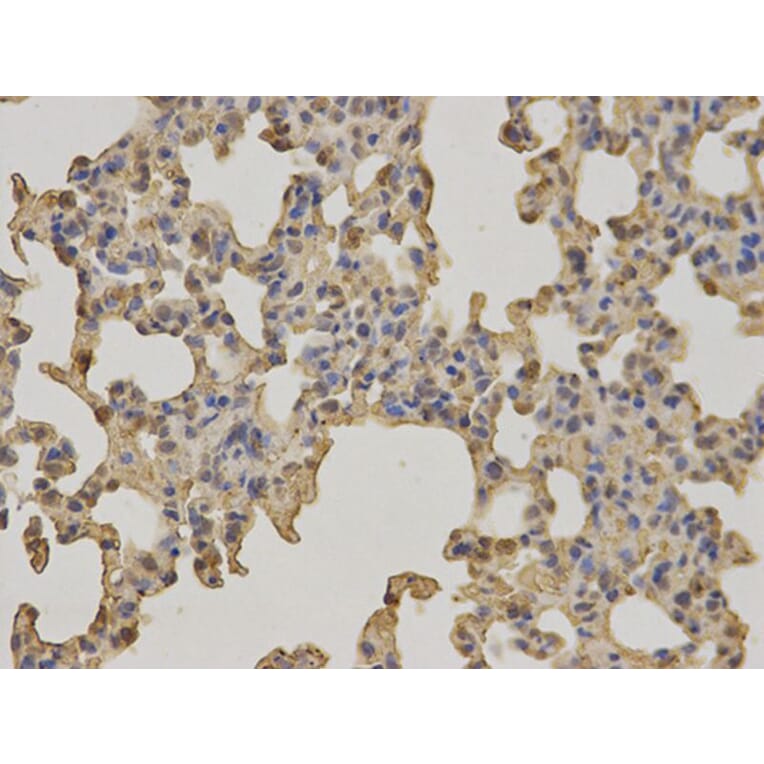 Immunohistochemistry - BTK Antibody from Signalway Antibody (32321) - Antibodies.com