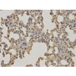 Immunohistochemistry - BTK Antibody from Signalway Antibody (32321) - Antibodies.com