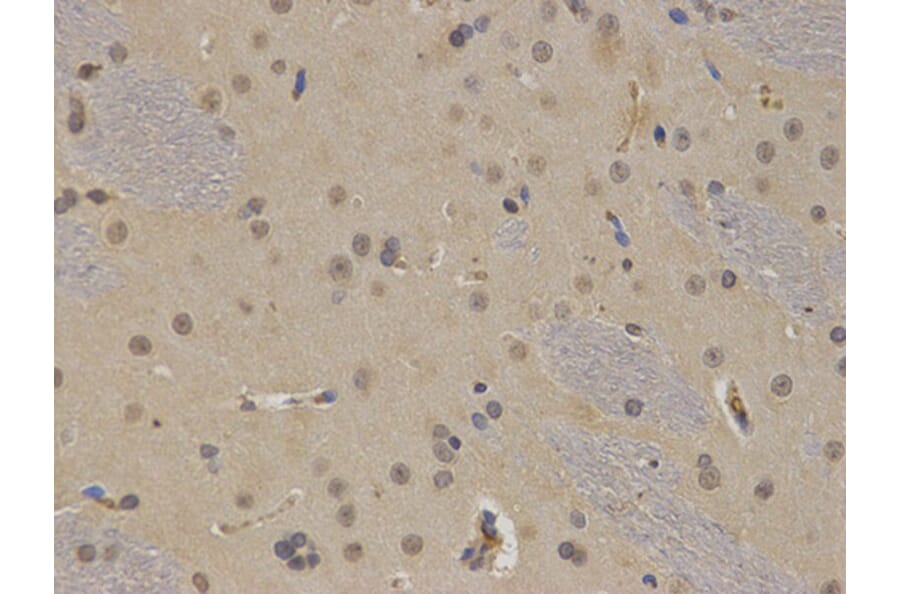 Immunohistochemistry - BTK Antibody from Signalway Antibody (32321) - Antibodies.com