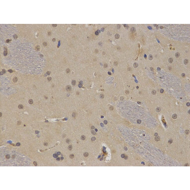 Immunohistochemistry - BTK Antibody from Signalway Antibody (32321) - Antibodies.com