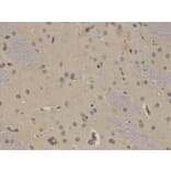 Immunohistochemistry - BTK Antibody from Signalway Antibody (32321) - Antibodies.com