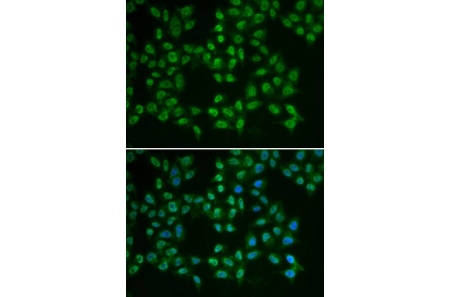 Immunofluorescence - BTK Antibody from Signalway Antibody (32321) - Antibodies.com
