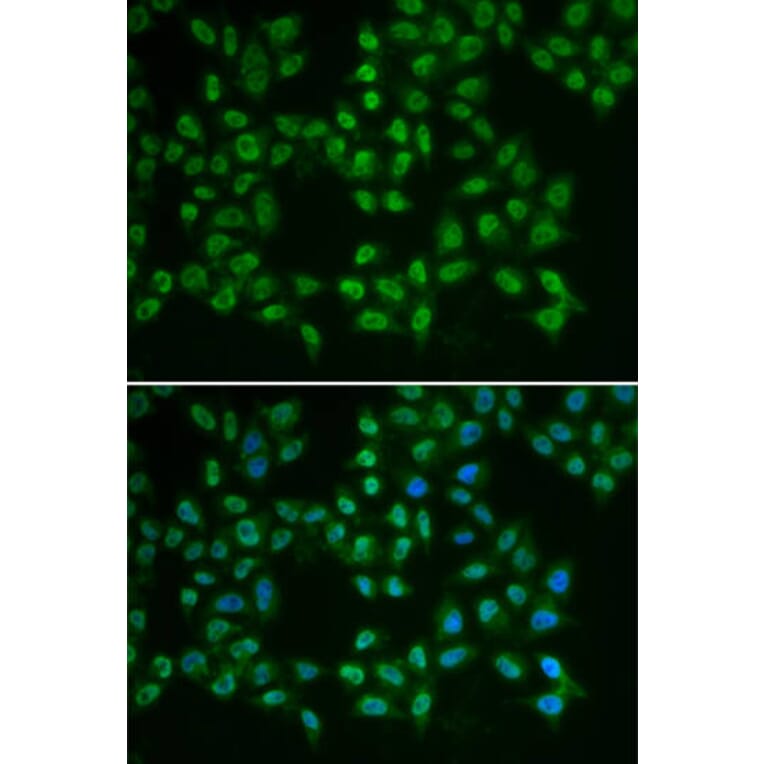 Immunofluorescence - BTK Antibody from Signalway Antibody (32321) - Antibodies.com
