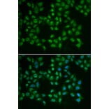 Immunofluorescence - BTK Antibody from Signalway Antibody (32321) - Antibodies.com