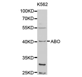 Western blot - ABO Antibody from Signalway Antibody (32328) - Antibodies.com