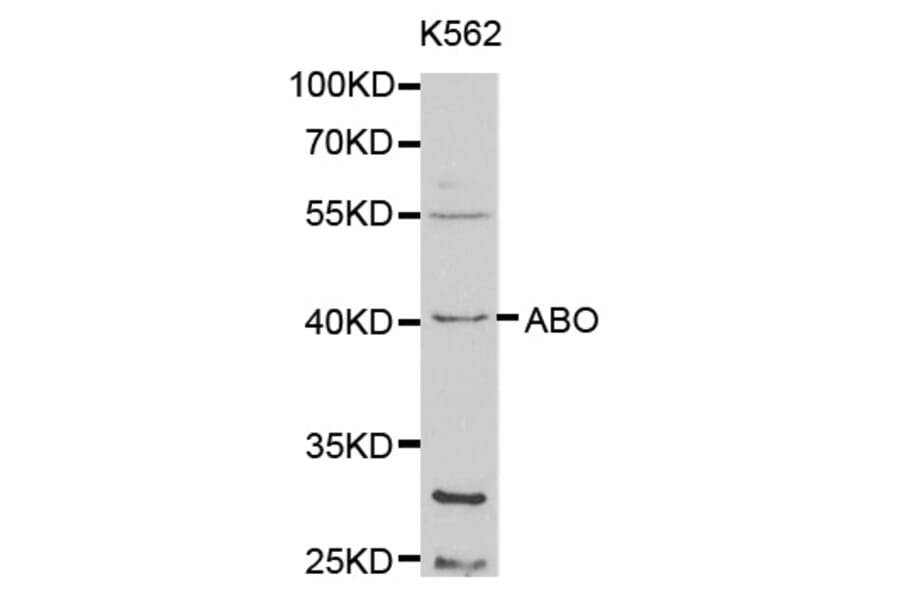 Western blot - ABO Antibody from Signalway Antibody (32328) - Antibodies.com