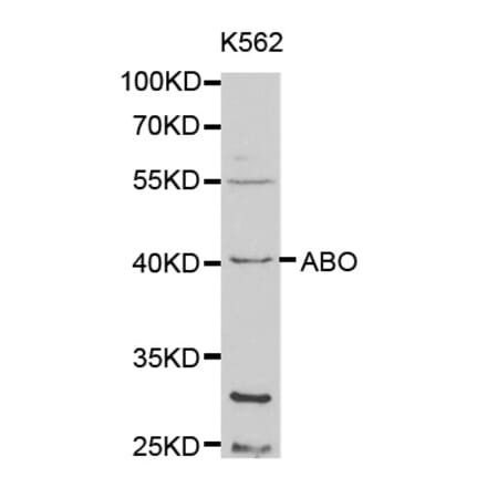 Western blot - ABO Antibody from Signalway Antibody (32328) - Antibodies.com