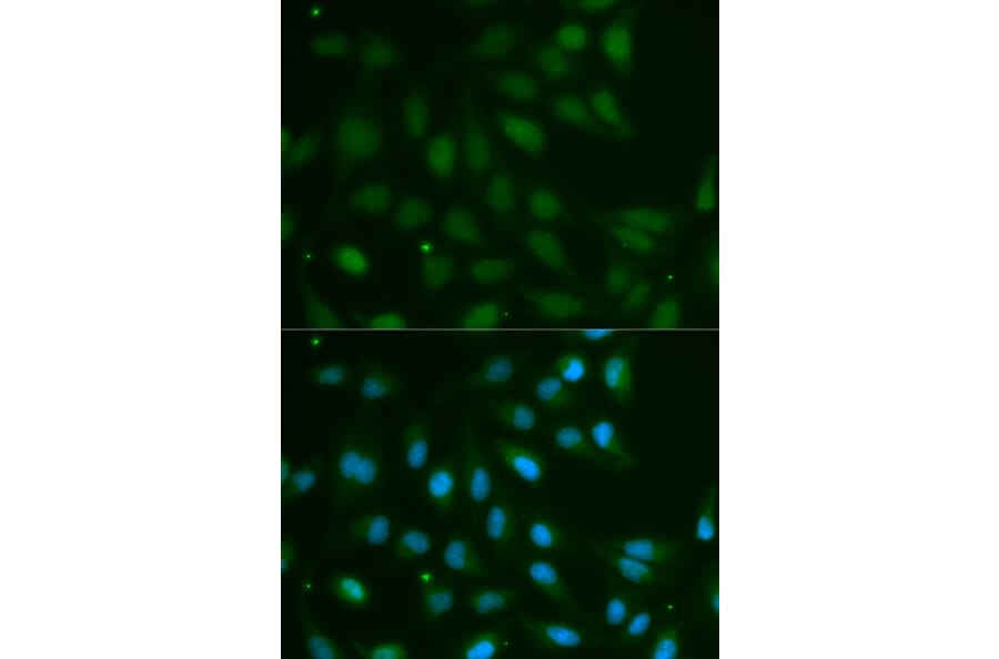 Immunofluorescence - ABO Antibody from Signalway Antibody (32328) - Antibodies.com