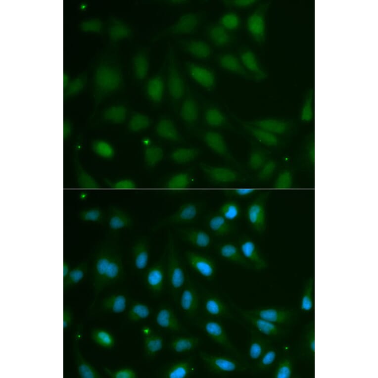 Immunofluorescence - ABO Antibody from Signalway Antibody (32328) - Antibodies.com