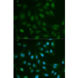 Immunofluorescence - ABO Antibody from Signalway Antibody (32328) - Antibodies.com