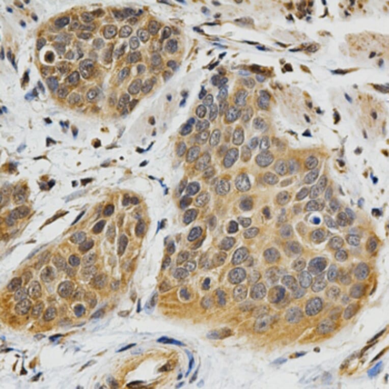 Immunohistochemistry - ABO Antibody from Signalway Antibody (32328) - Antibodies.com