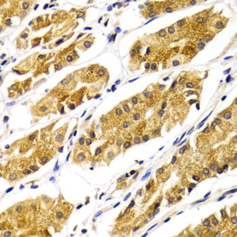 Immunohistochemistry - ABO Antibody from Signalway Antibody (32328) - Antibodies.com