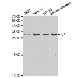 Western blot - IL7 Antibody from Signalway Antibody (32367) - Antibodies.com