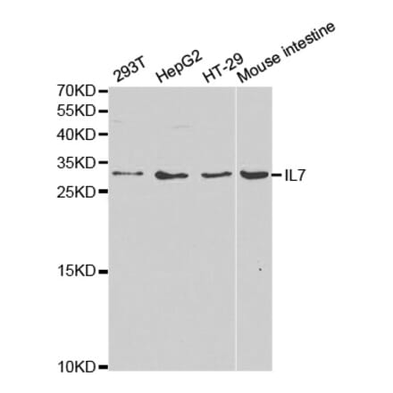 Western blot - IL7 Antibody from Signalway Antibody (32367) - Antibodies.com