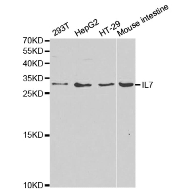 Western blot - IL7 Antibody from Signalway Antibody (32367) - Antibodies.com