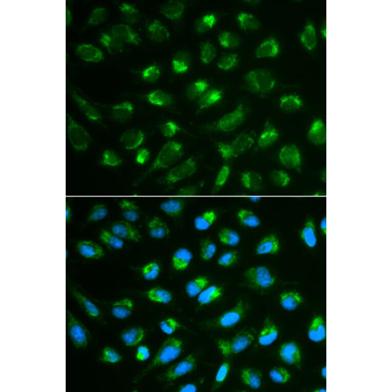 Immunofluorescence - IL7 Antibody from Signalway Antibody (32367) - Antibodies.com