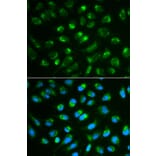 Immunofluorescence - IL7 Antibody from Signalway Antibody (32367) - Antibodies.com