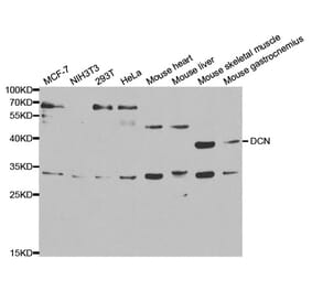 Western blot - DCN Antibody from Signalway Antibody (32376) - Antibodies.com