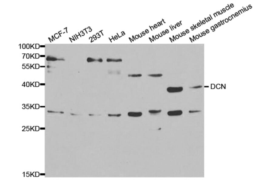 Western blot - DCN Antibody from Signalway Antibody (32376) - Antibodies.com