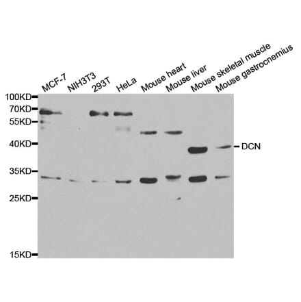 Western blot - DCN Antibody from Signalway Antibody (32376) - Antibodies.com