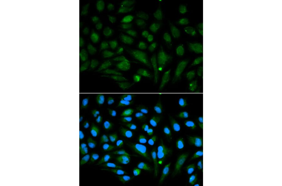 Immunofluorescence - DCN Antibody from Signalway Antibody (32376) - Antibodies.com