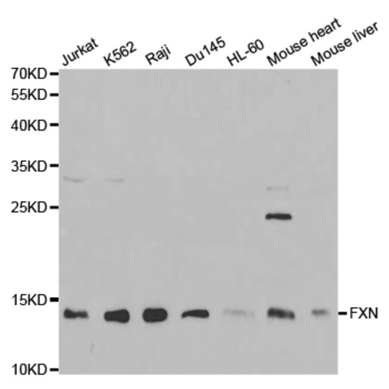 Western blot - FXN Antibody from Signalway Antibody (32413) - Antibodies.com