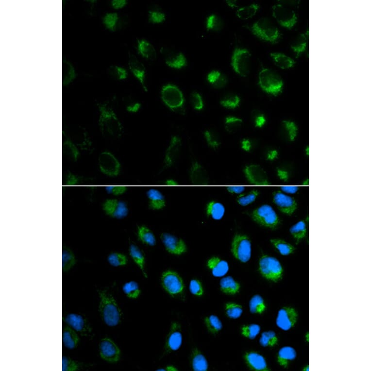 Immunofluorescence - FXN Antibody from Signalway Antibody (32413) - Antibodies.com
