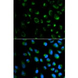 Immunofluorescence - FXN Antibody from Signalway Antibody (32413) - Antibodies.com