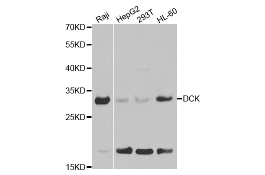 Western blot - DCK Antibody from Signalway Antibody (32437) - Antibodies.com