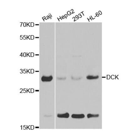 Western blot - DCK Antibody from Signalway Antibody (32437) - Antibodies.com