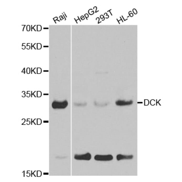 Western blot - DCK Antibody from Signalway Antibody (32437) - Antibodies.com