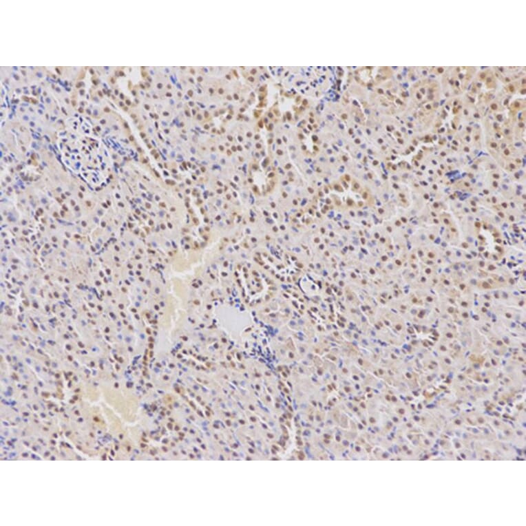 Immunohistochemistry - DCK Antibody from Signalway Antibody (32437) - Antibodies.com