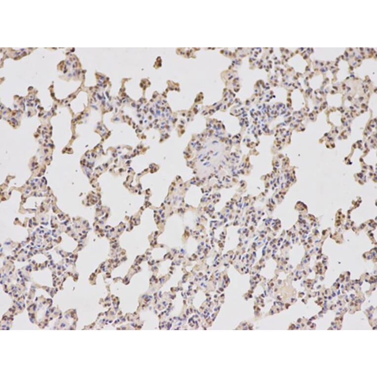 Immunohistochemistry - DCK Antibody from Signalway Antibody (32437) - Antibodies.com