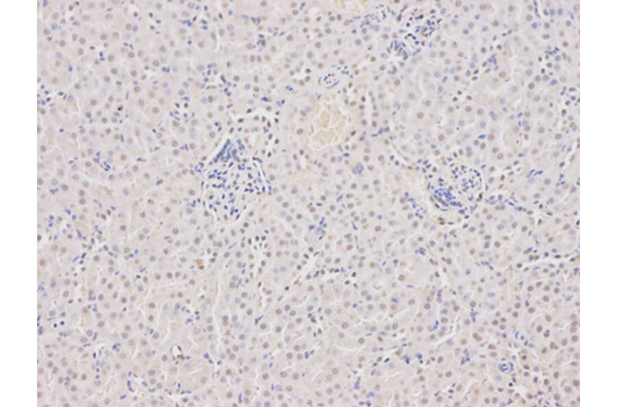 Immunohistochemistry - DCK Antibody from Signalway Antibody (32437) - Antibodies.com